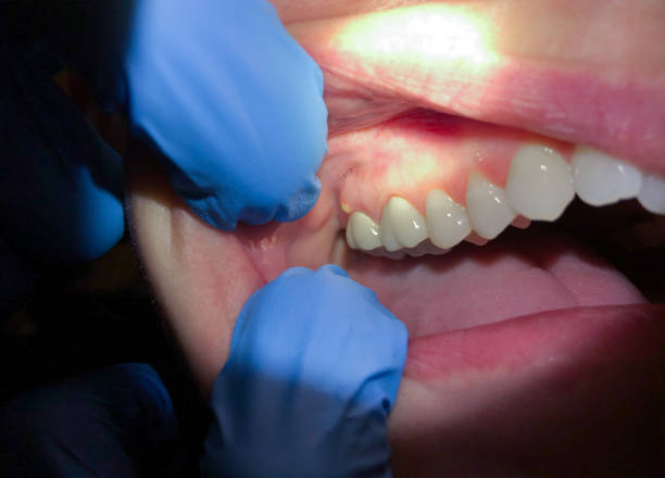 Best Tooth Pain Emergency Relief  in Paulding, OH