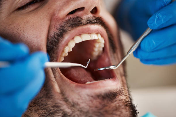 Best Broken Tooth Emergency  in Paulding, OH