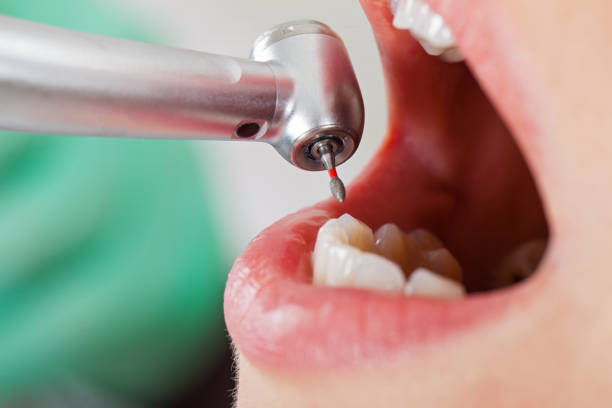 Best Emergency Tooth Extraction  in Paulding, OH